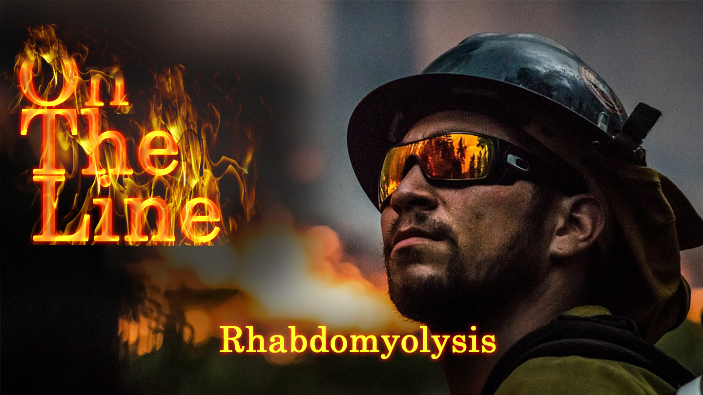 Rhabdo