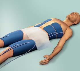 Podcast #205: Post Cardiac Arrest Temperature Control