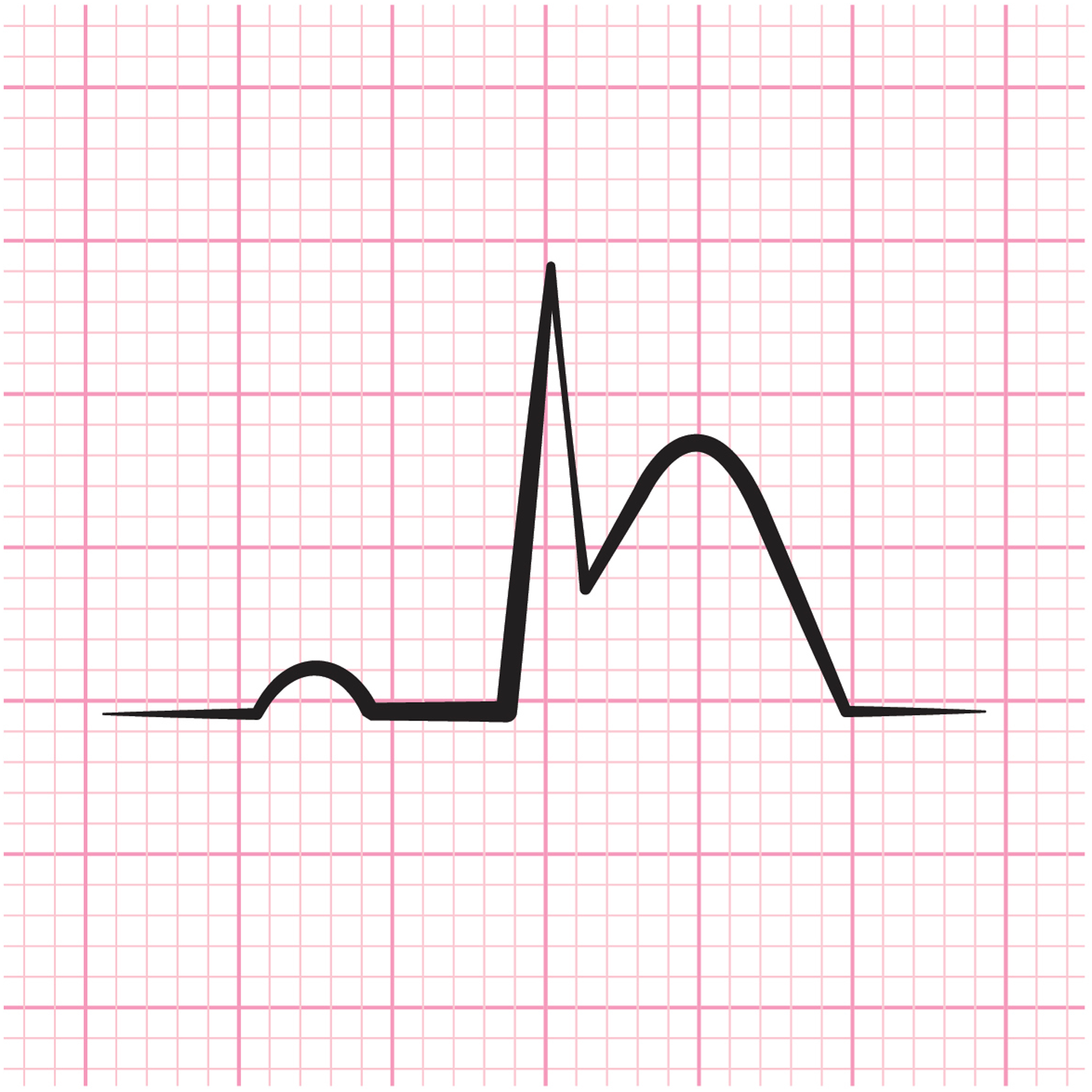 JAMA Cardiology Author Interviews