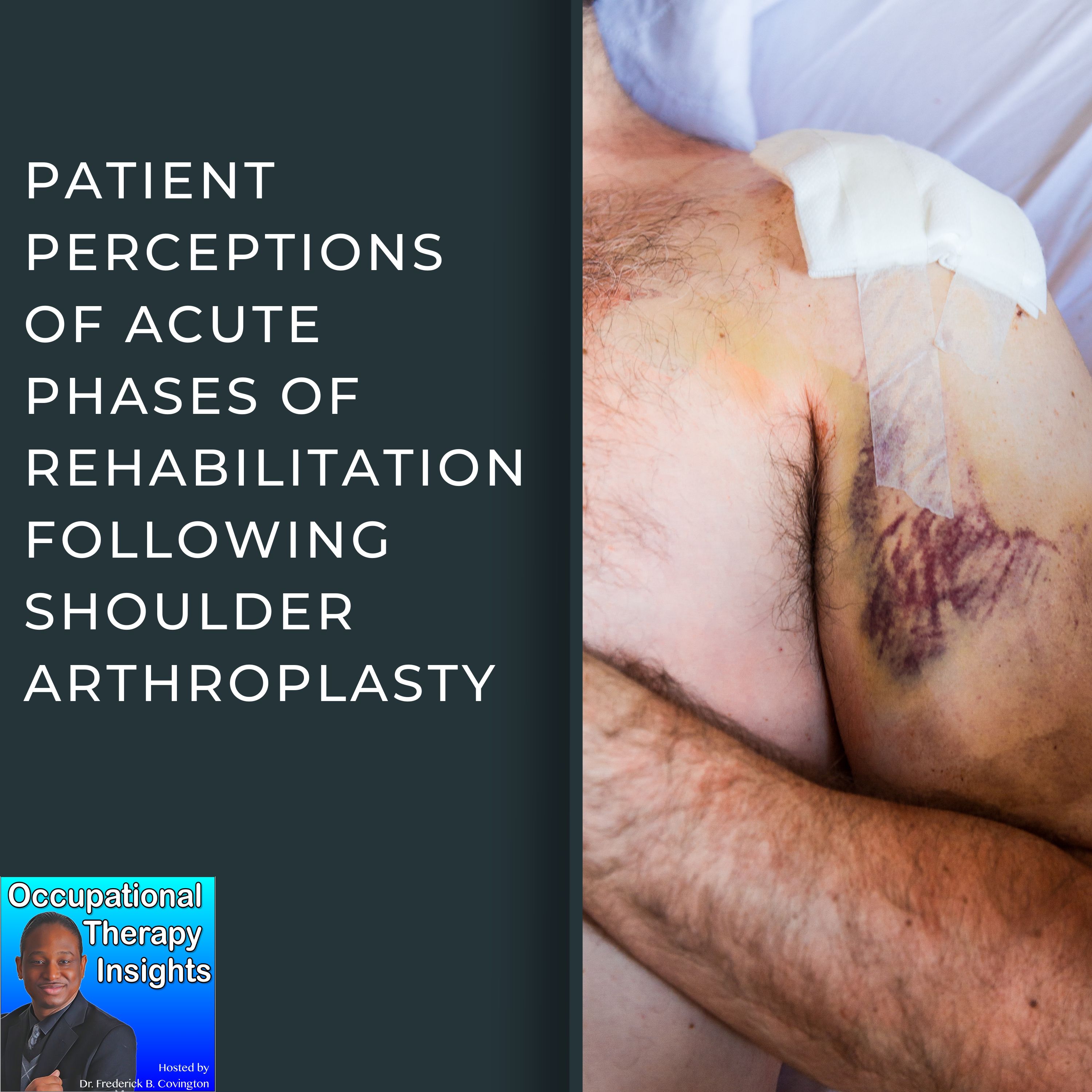 Patient Perceptions of Acute Phases of Rehabilitation Following Shoulder Arthroplasty