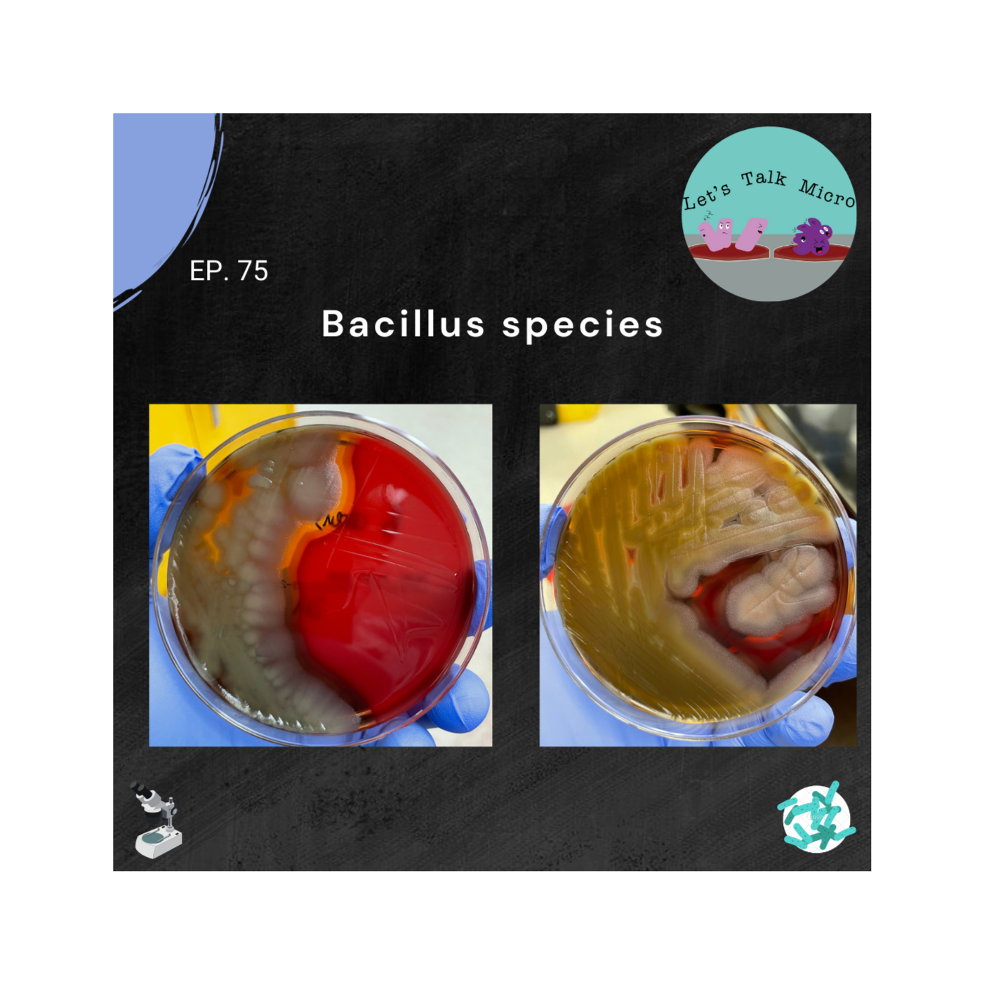75: Bacillus species