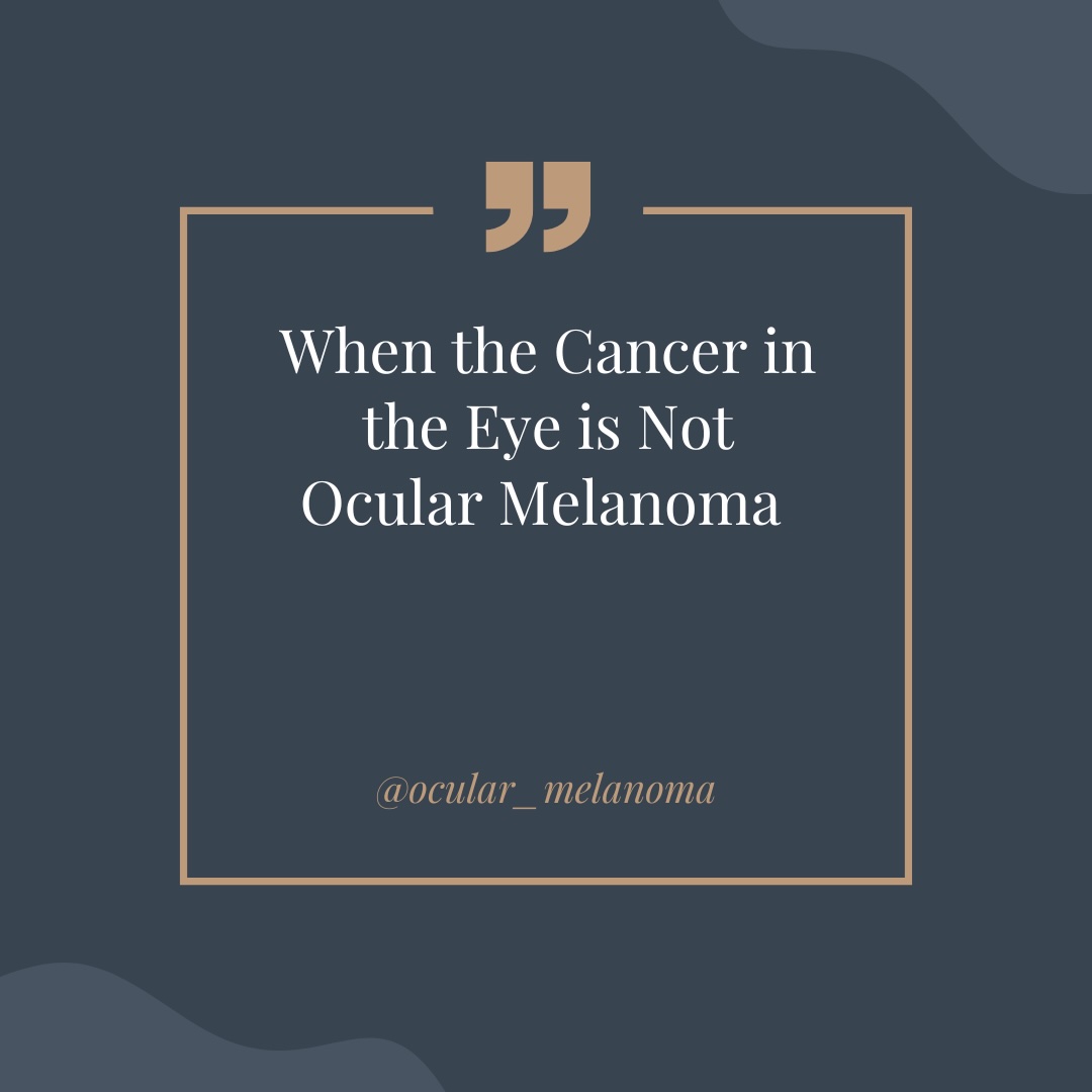 Finding Your Way with Ocular Melanoma