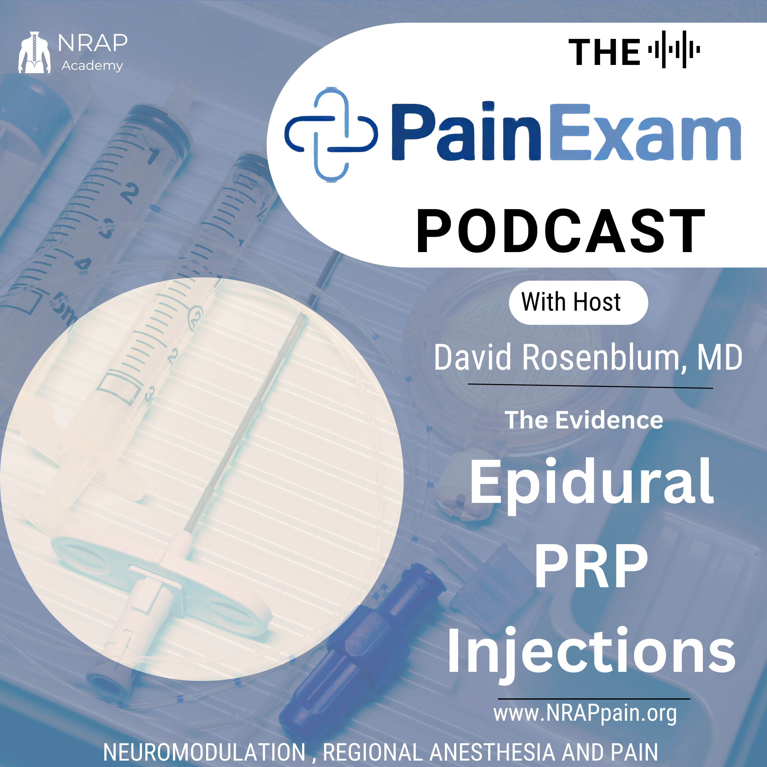 PRP in the Epidural Space for Radiculopathy