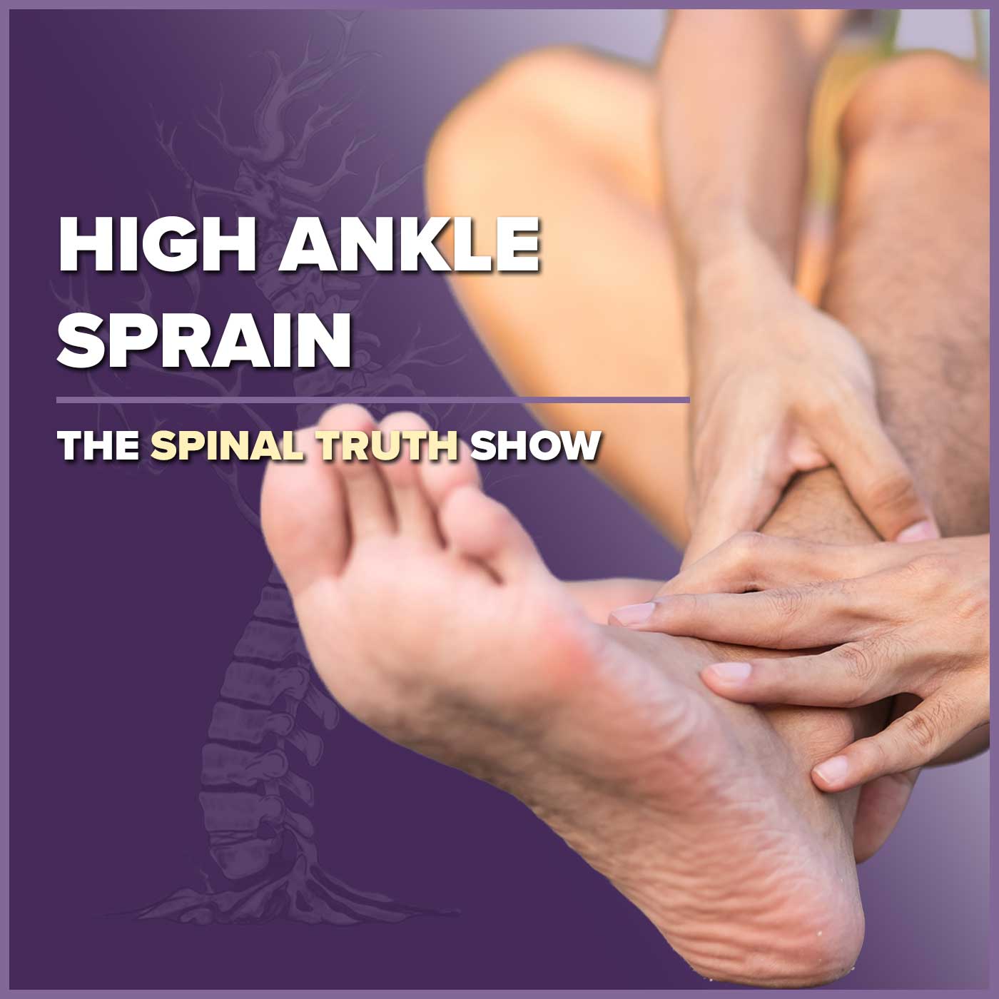 High Ankle Sprain
