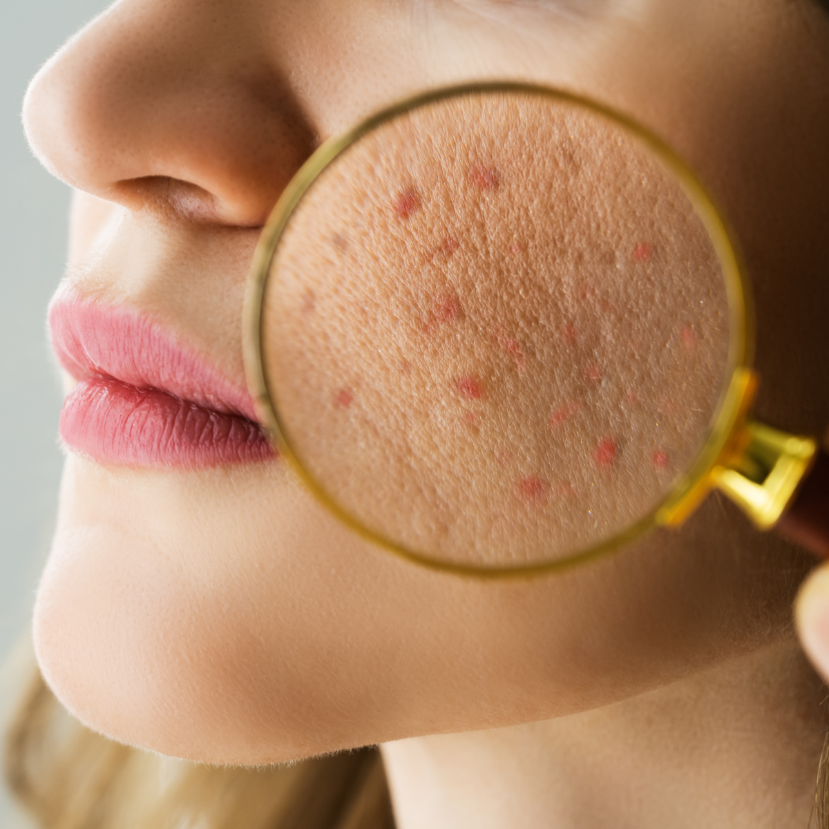 Skin Theory with Emme Diane