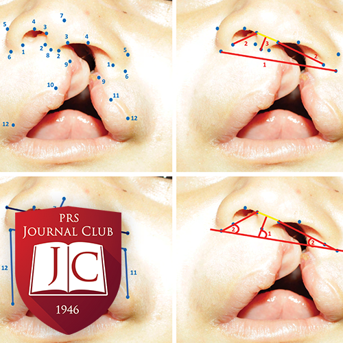 PRS Journal Club