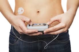 Podcast 711: Insulin Pumps