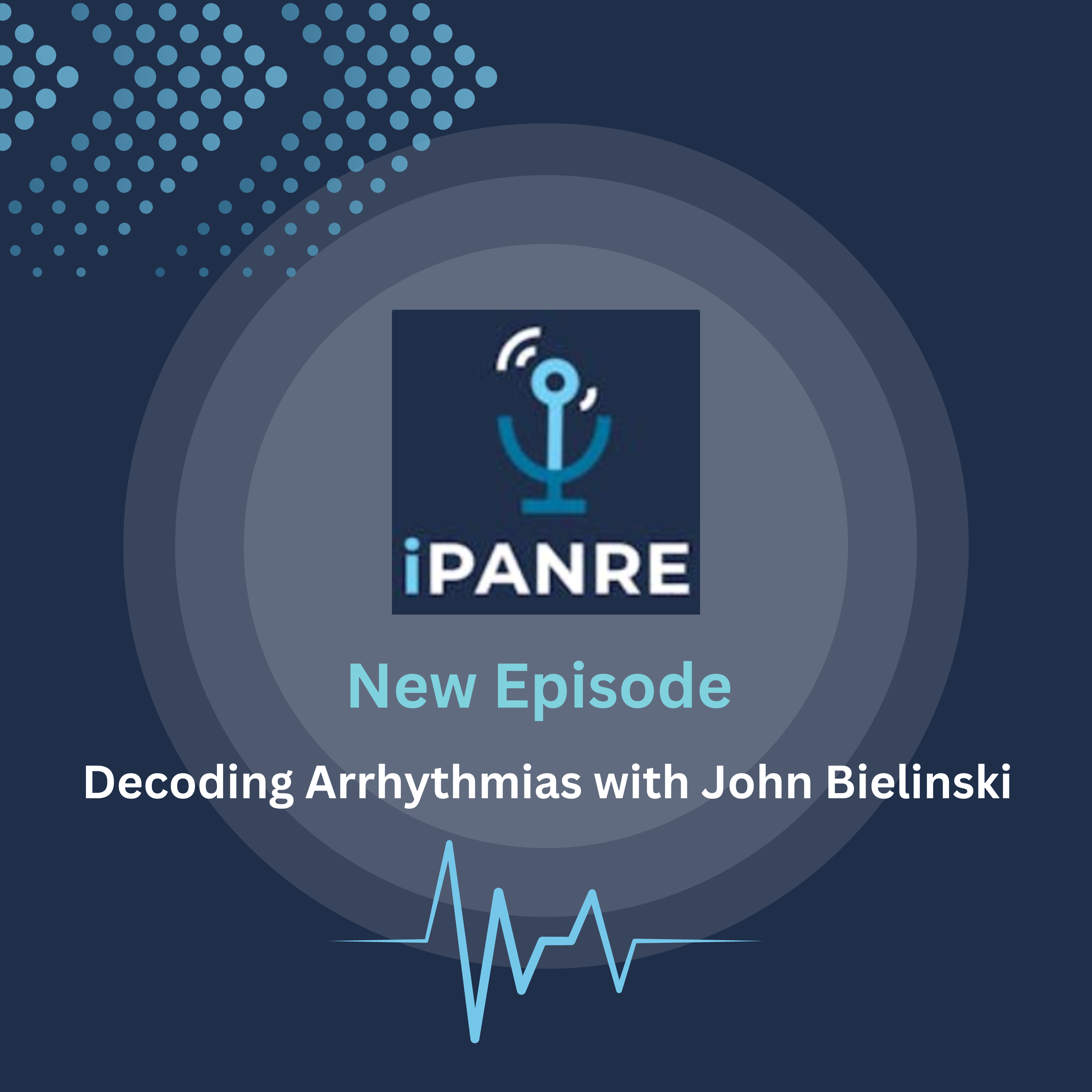 Decoding Arrhythmias with John Bielinski