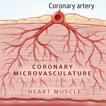 JAMA Cardiology Author Interviews
