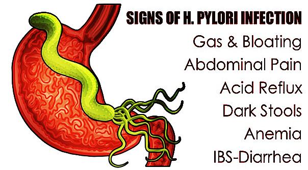Case Study - Using Frequency Wavelengths to Treat H. Pylori Infection