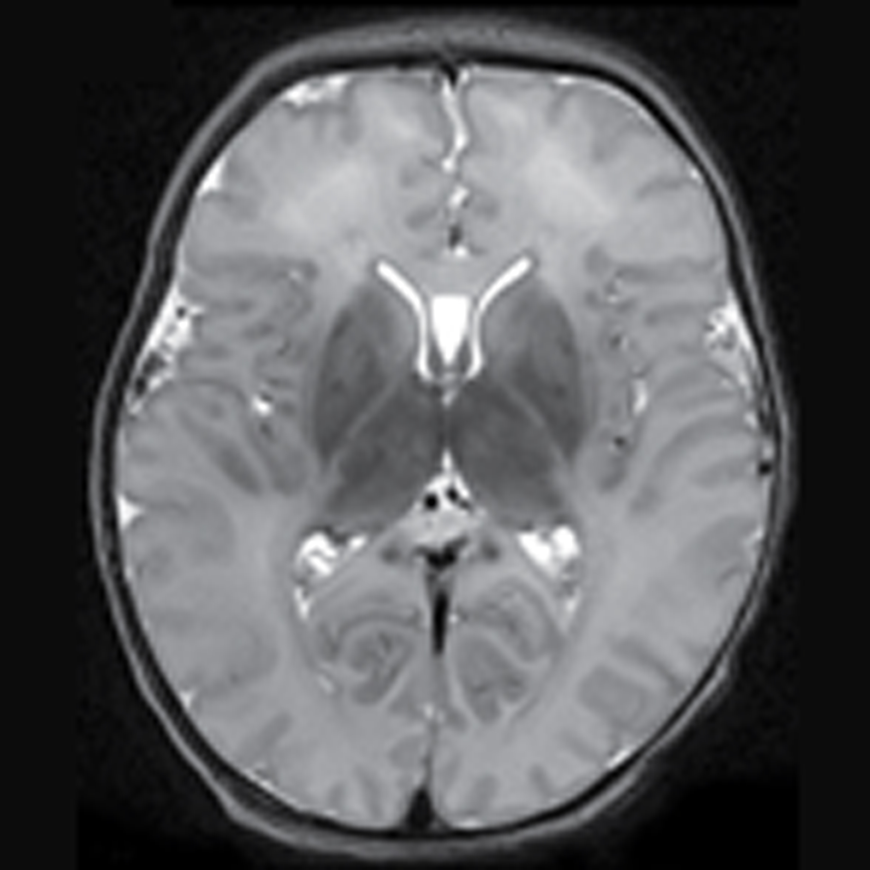 JAMA Neurology Author Interviews