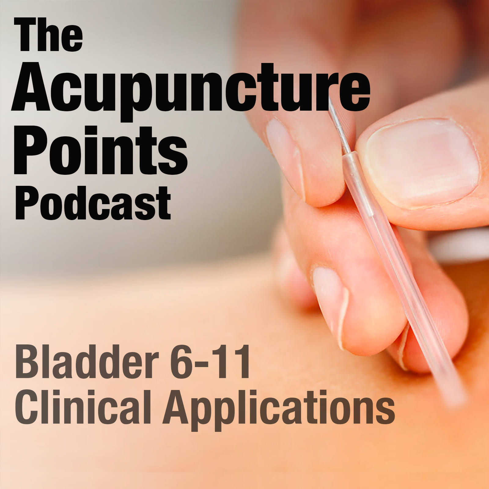 Acupuncture Points and their Clinical Application