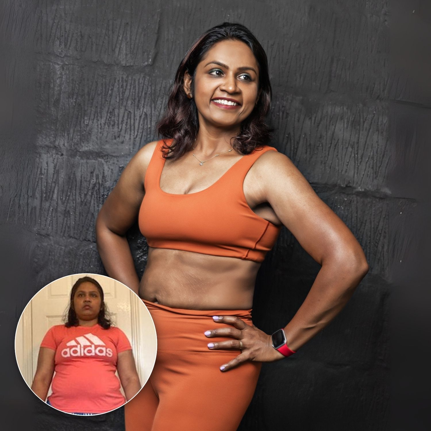 Ep 448 - Hall Of Fame | Anila Pandian: Reversing Diabetes, Confidence In Clothes & 30kgs Down!