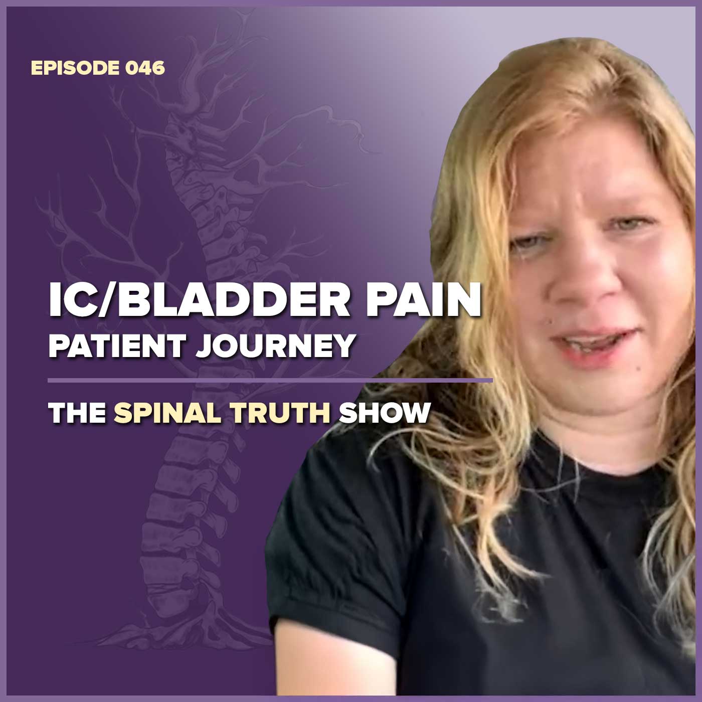 IC/Bladder Pain - Patient Journey