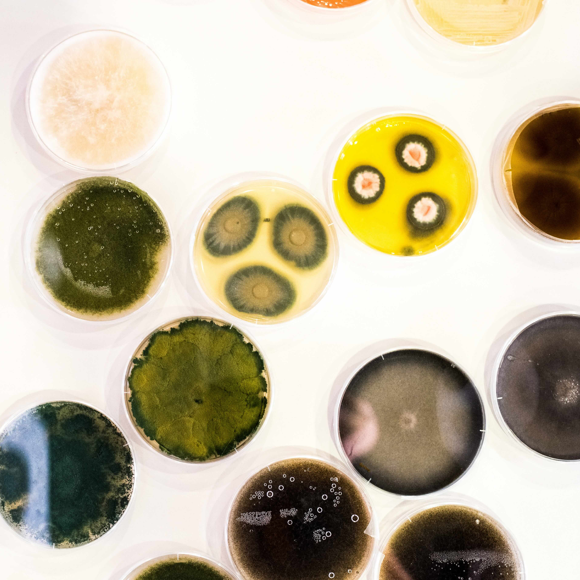 Why Are There Germs?