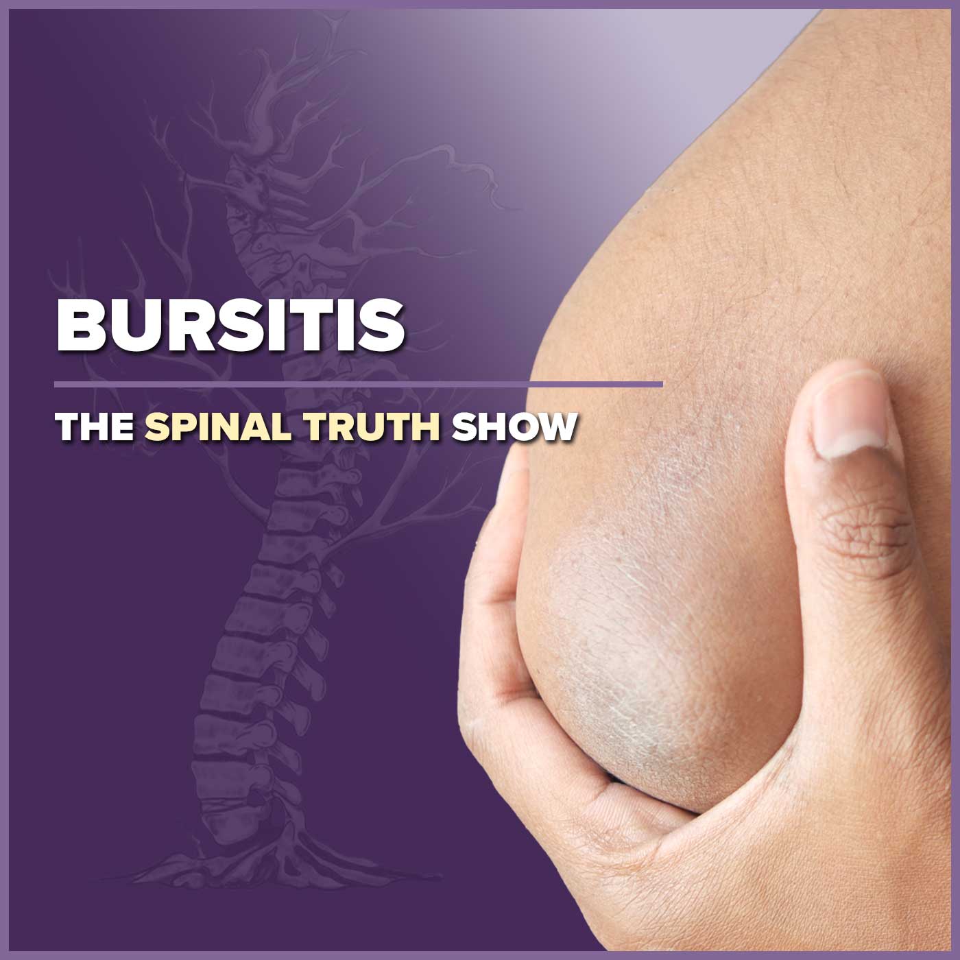 Bursitis: The Diagnosis Almost Everyone Gets Wrong
