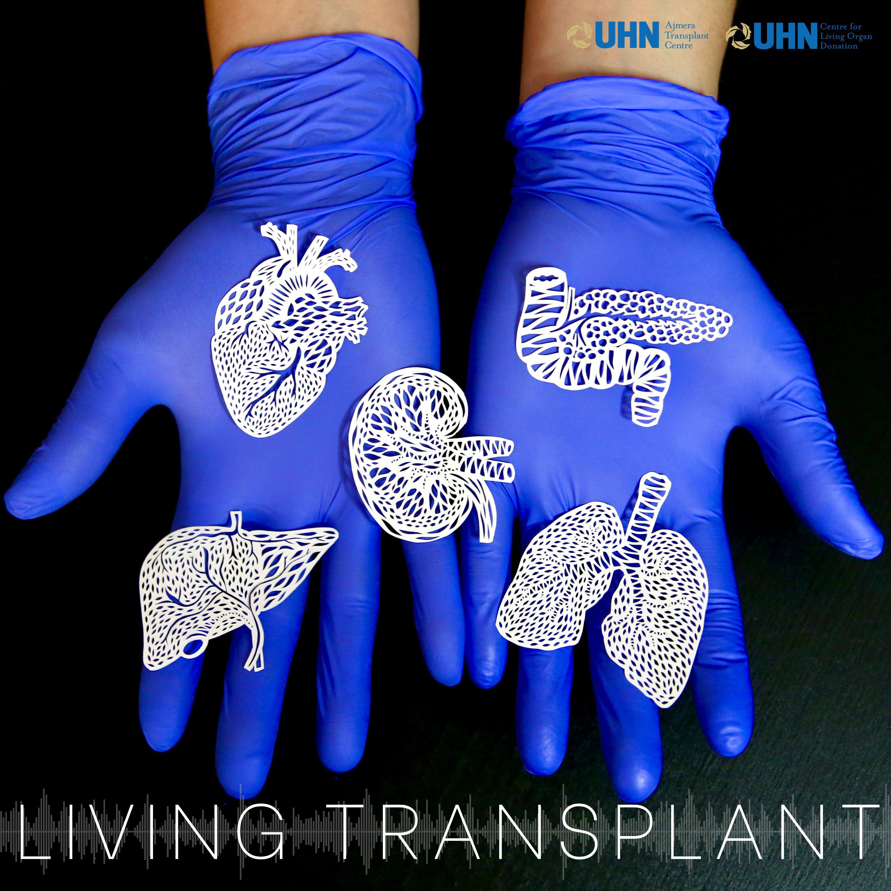 Living Transplant