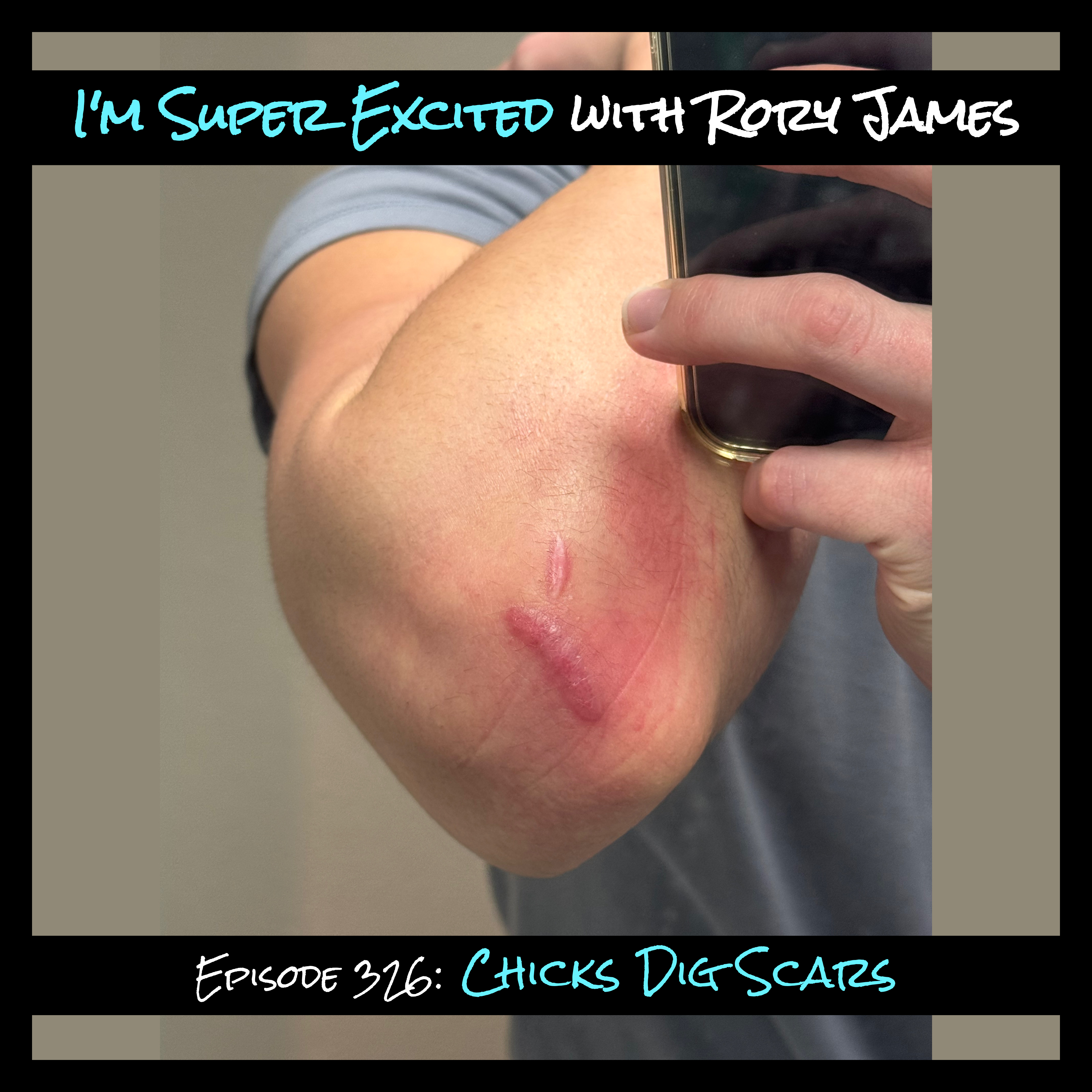 Chicks Dig Scars