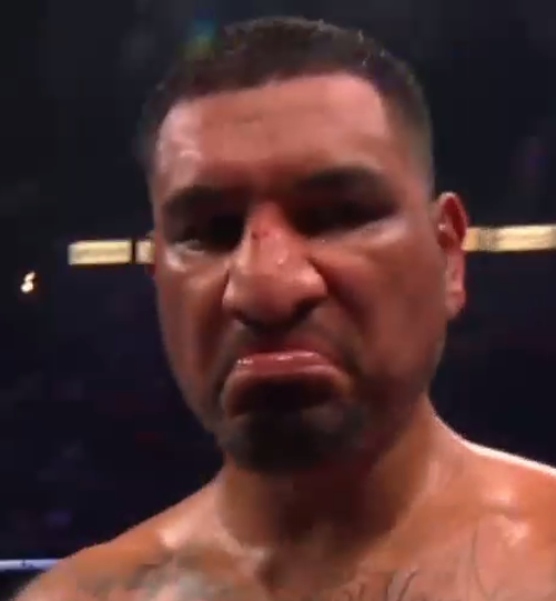 The (un)Professional Boxing Podcast