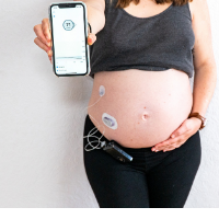 Zuckerjunkies - Ein Leben mit Diabetes Typ 1 Diabetiker Podcast mit Sascha Schworm
