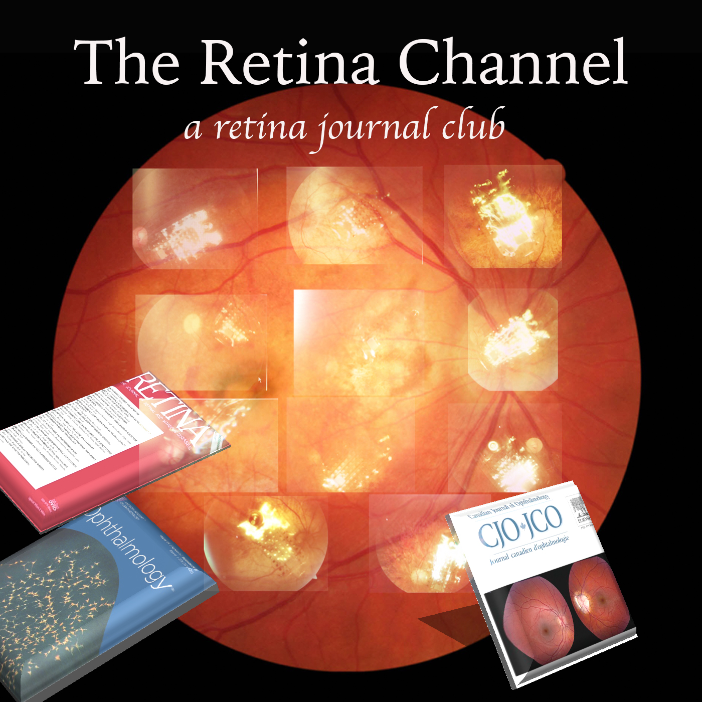 The Retina Channel Podcast