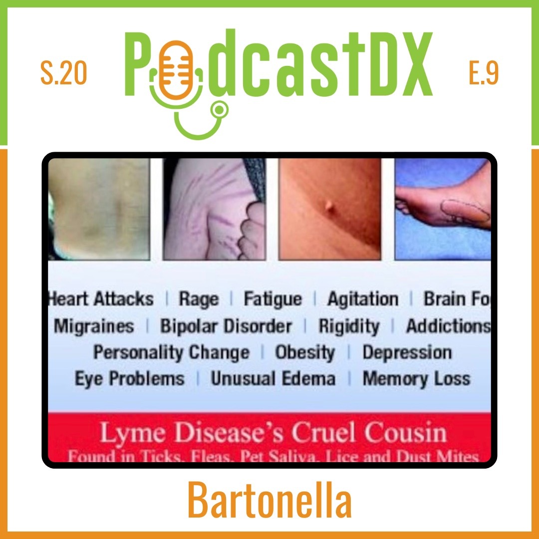 Bartonella