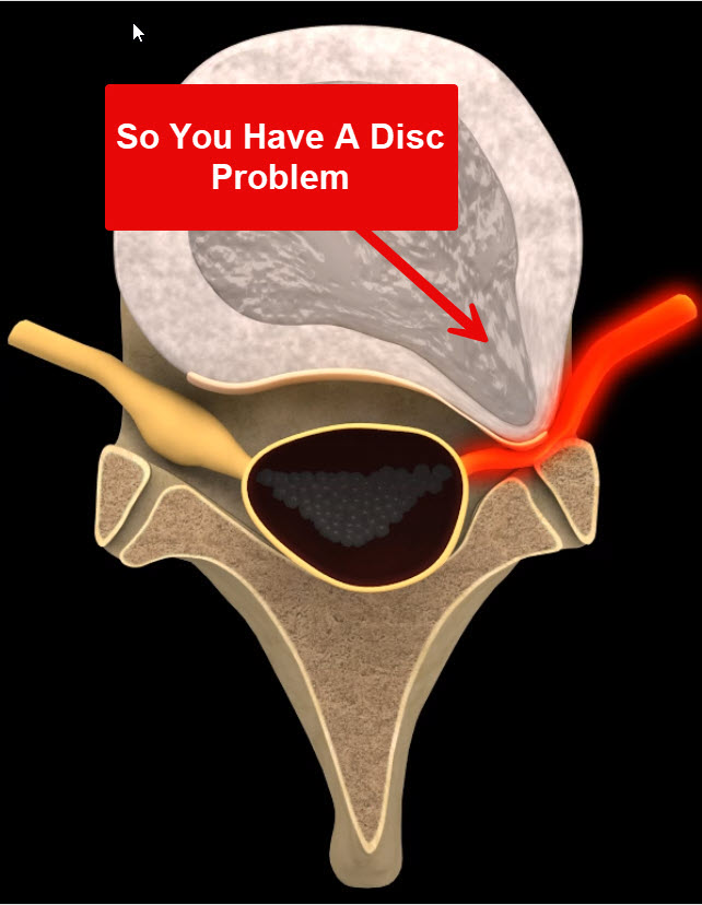 What Is Chronic Pain