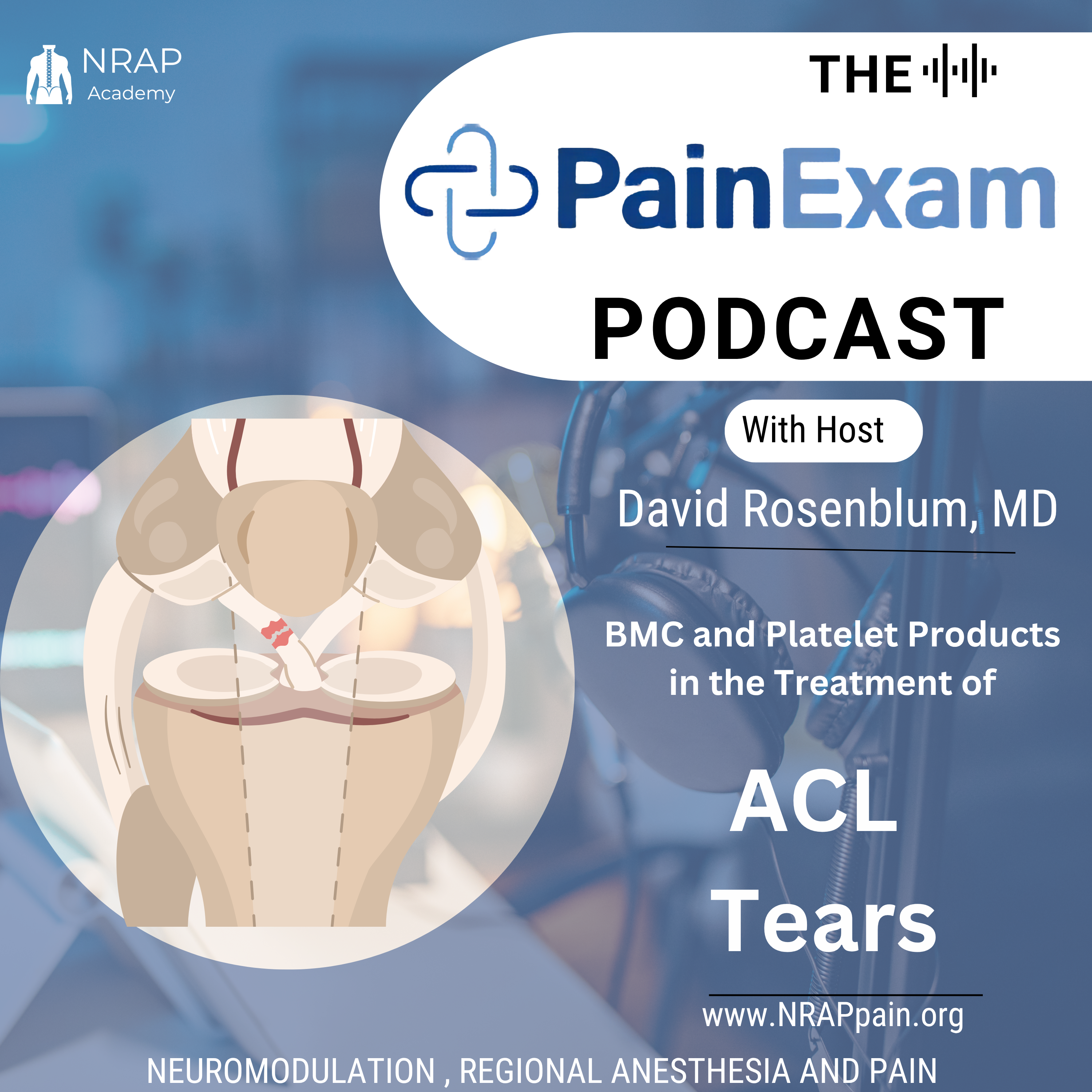 BMAC and PRP for ACL Tears- Journal Club