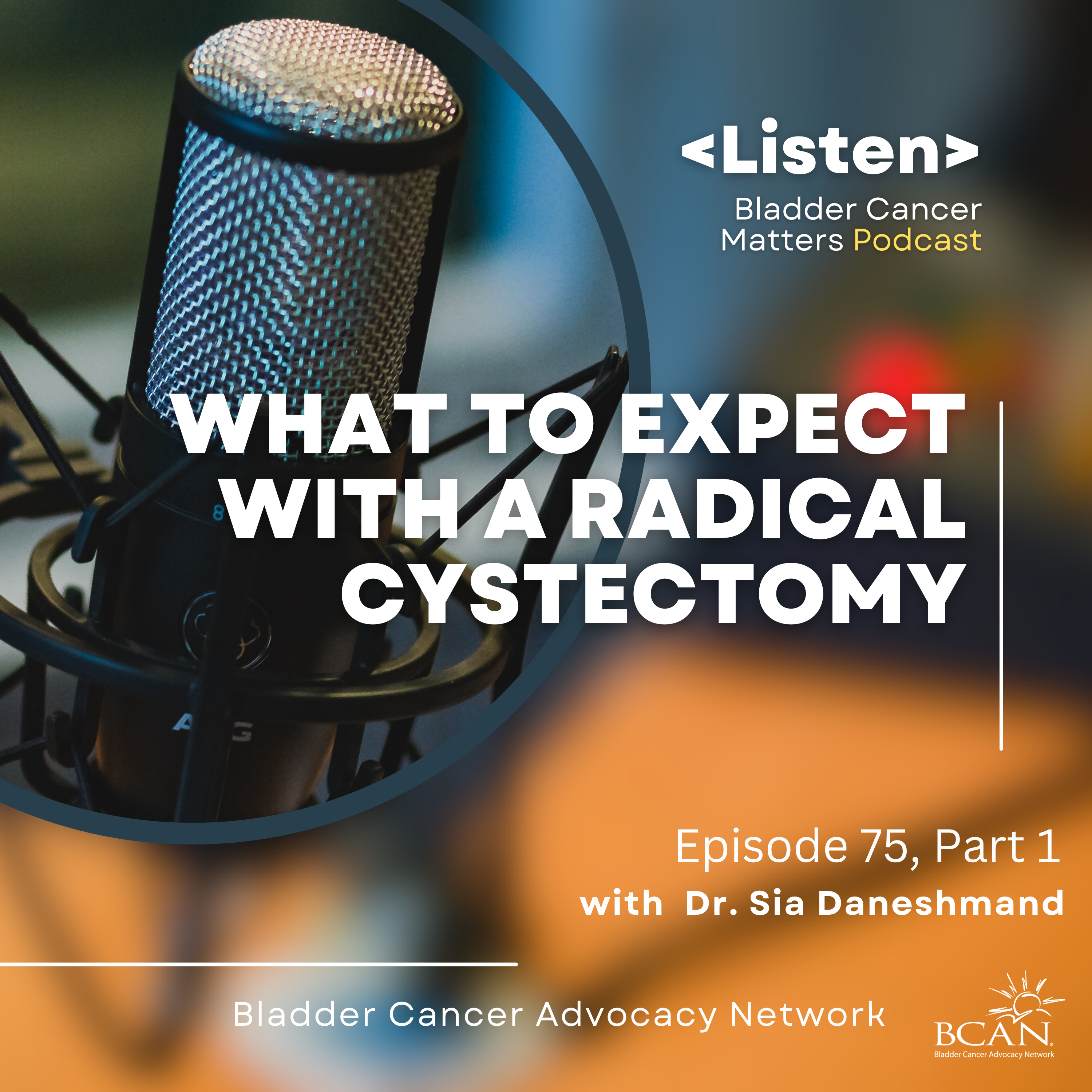 What to Expect with a Radical Cystectomy, Part 1